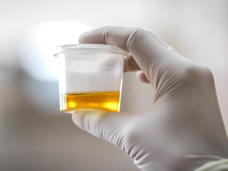 Urine Specimen Collection